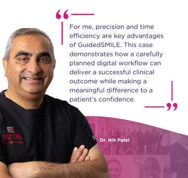 Restoring Confidence Through GuidedSMILE: A Dual Arch FP3 Case Study by Dr Nik Patel