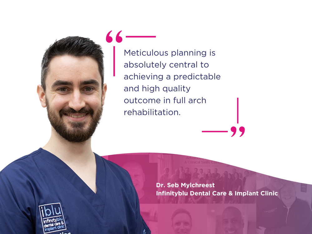 GuidedSMILE Case Study – Full Arch Rehabilitation