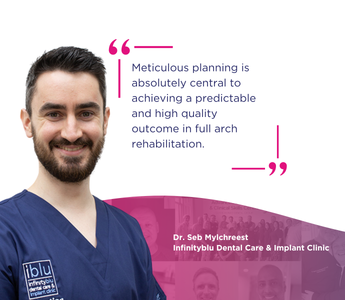 GuidedSMILE Case Study – Full Arch Rehabilitation