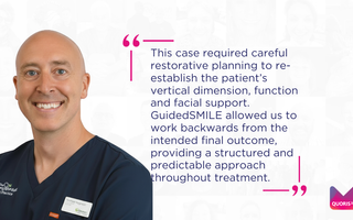 Restoring Function and Confidence with GuidedSMILE: A Dual Arch Rehabilitation by Dr Matthew Higginson