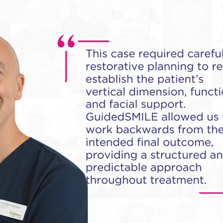 Restoring Function and Confidence with GuidedSMILE: A Dual Arch Rehabilitation by Dr Matthew Higginson