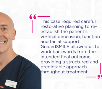 Restoring Function and Confidence with GuidedSMILE: A Dual Arch Rehabilitation by Dr Matthew Higginson