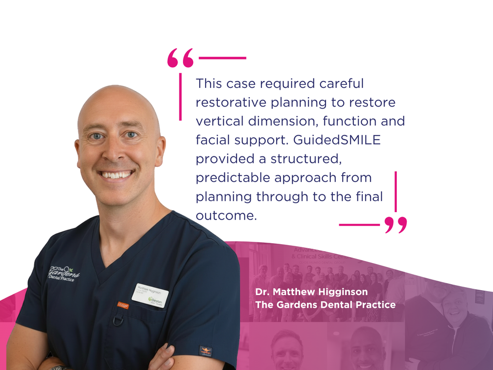 Restoring Function and Confidence with GuidedSMILE: A Dual Arch Rehabilitation by Dr Matthew Higginson