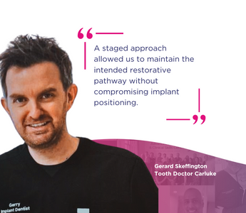 Staged Implant Placement in Dual Arch Rehabilitation: A Case Study by Dr Gerry Skeffington