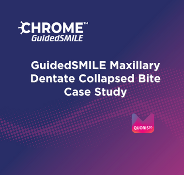 GuidedSMILE Maxillary Dentate Collapsed Bite Case Study