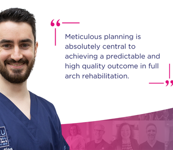 GuidedSMILE Case Study – Full Arch Rehabilitation