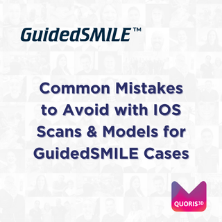 Common Mistakes to Avoid with IOS Scans & Models for GuidedSMILE Cases