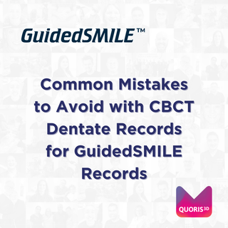 Common Mistakes to Avoid with CBCT Dentate Records for GuidedSMILE Records