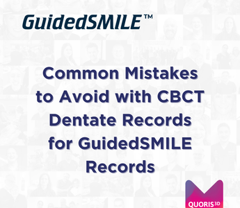 Common Mistakes to Avoid with CBCT Dentate Records for GuidedSMILE Records