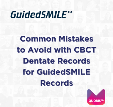 Common Mistakes to Avoid with CBCT Dentate Records for GuidedSMILE Records