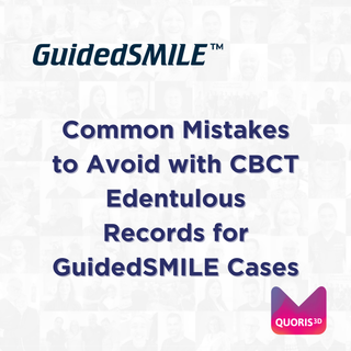 Common Mistakes to Avoid with CBCT Edentulous Records for GuidedSMILE Cases