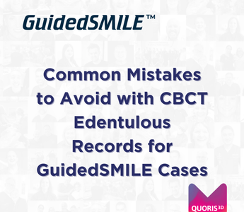 Common Mistakes to Avoid with CBCT Edentulous Records for GuidedSMILE Cases