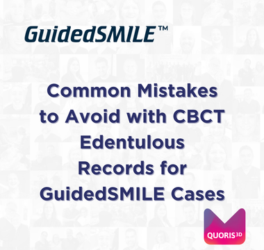Common Mistakes to Avoid with CBCT Edentulous Records for GuidedSMILE Cases