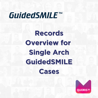 Records Overview for Single Arch GuidedSMILE Cases