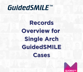 Records Overview for Single Arch GuidedSMILE Cases