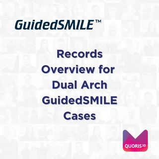 Records Overview for Dual Arch GuidedSMILE Cases