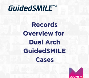 Records Overview for Dual Arch GuidedSMILE Cases