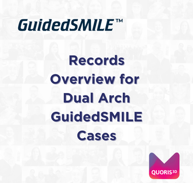Records Overview for Dual Arch GuidedSMILE Cases