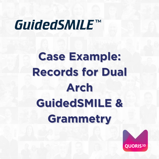 Case Example: Records for Dual Arch GuidedSMILE & Grammetry