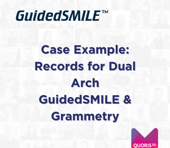 Case Example: Records for Dual Arch GuidedSMILE & Grammetry
