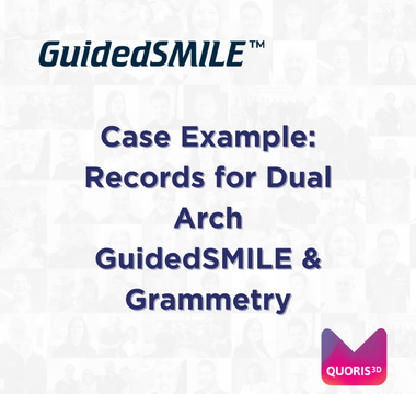 Case Example: Records for Dual Arch GuidedSMILE & Grammetry
