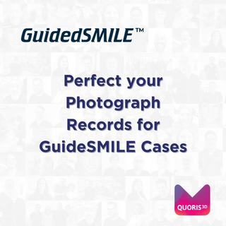 CBCT Scans for Dentate & Edentulous GuidedSMILE Cases