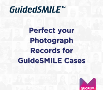 CBCT Scans for Dentate & Edentulous GuidedSMILE Cases
