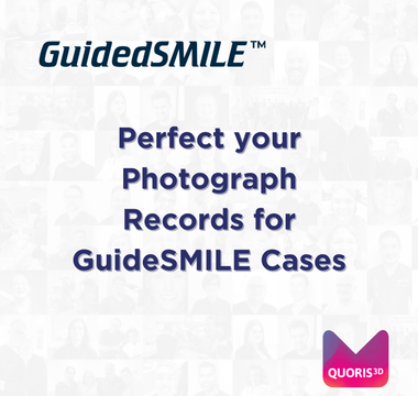 CBCT Scans for Dentate & Edentulous GuidedSMILE Cases