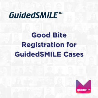 Good Bite Registration for GuidedSMILE Cases