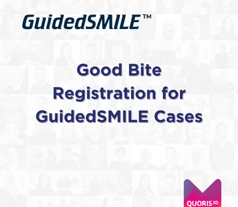 Good Bite Registration for GuidedSMILE Cases