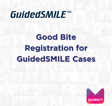 Good Bite Registration for GuidedSMILE Cases