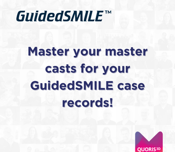Good Master Casts and Impressions for GuidedSMILE Cases