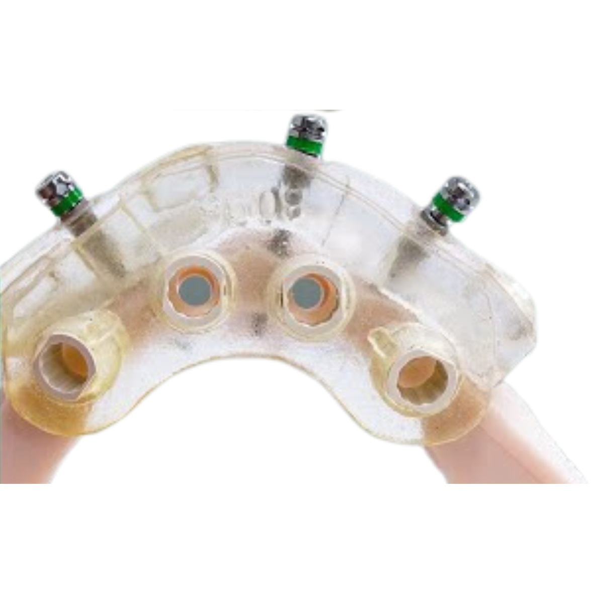 GuidedSMILE Surgery Lite