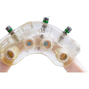 GuidedSMILE Surgery Lite