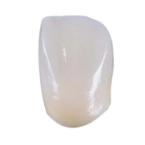 Temporary Conventional Crown