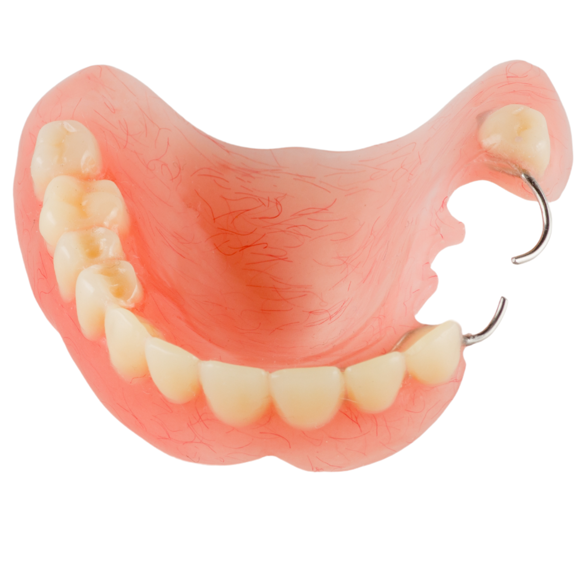 Tooth Clasp