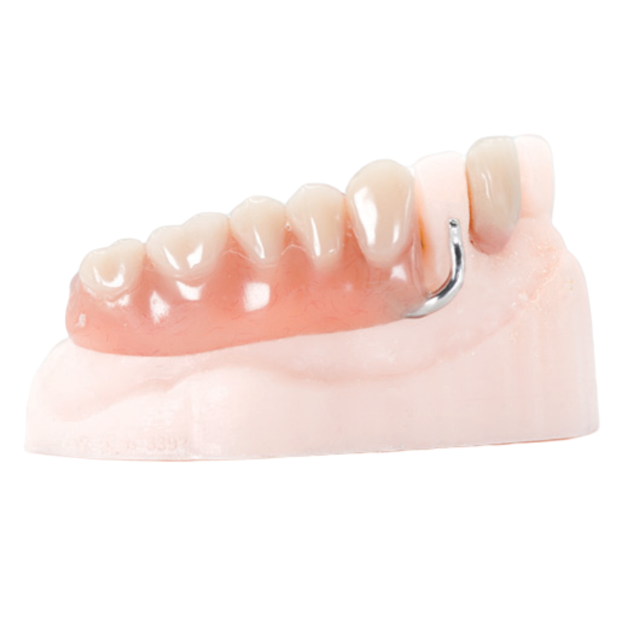 Partial IMPACT Dentures