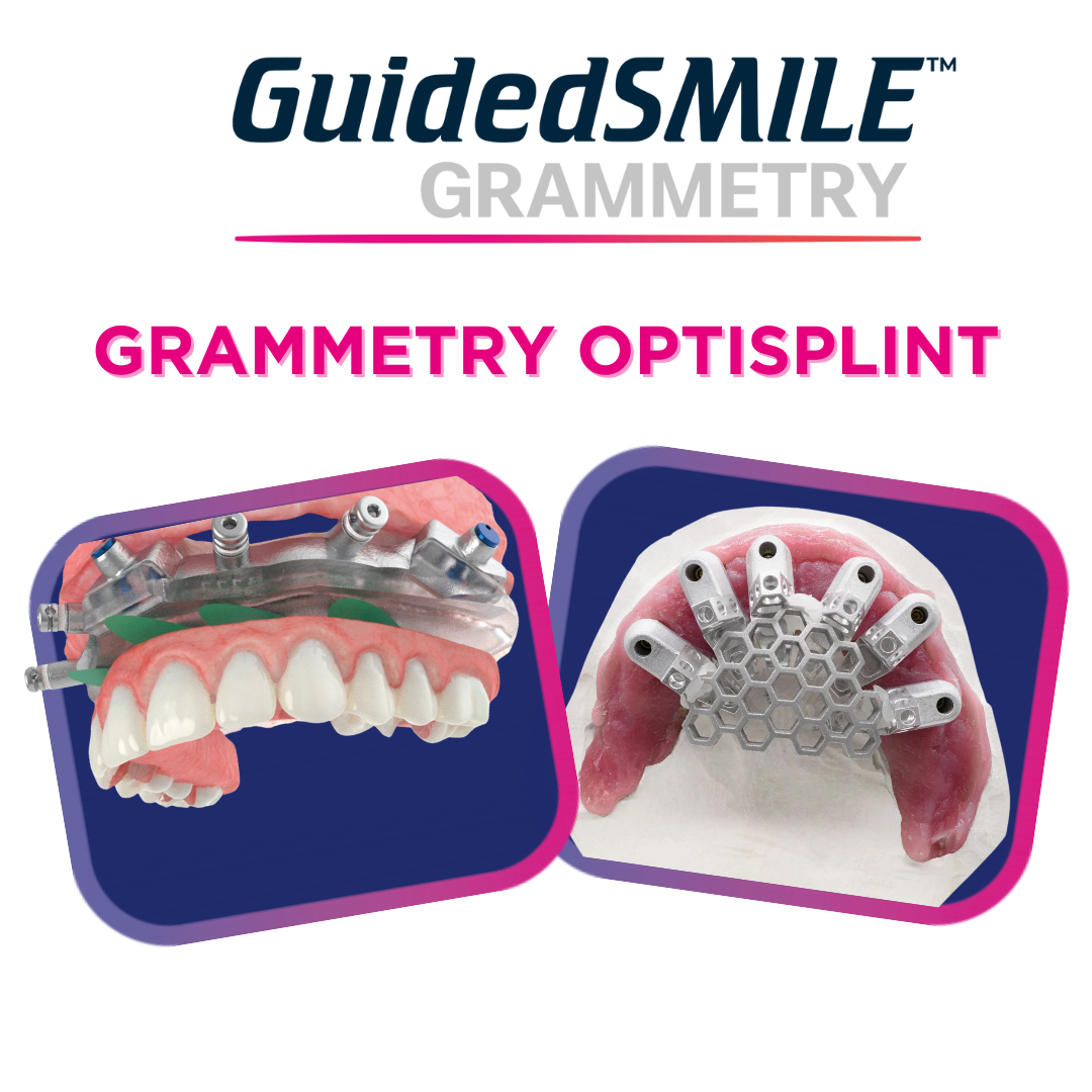 GuidedSMILE Grammetry Complete: Grammetry Optisplint