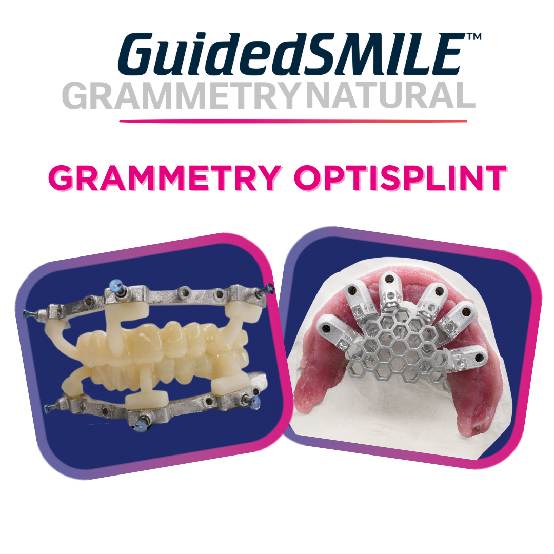 GuidedSMILE_Grammetry_Natural_-_Grammetry_Optisplint
