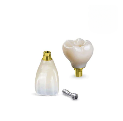 Porcelain Fused Zirconia Implant Crown (PFZ-I)
