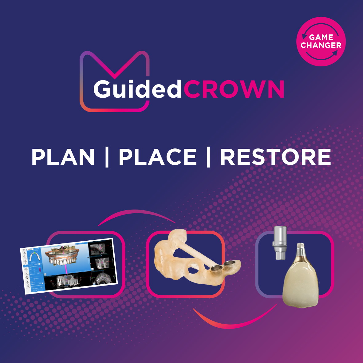 Add to Case: Guided Crown