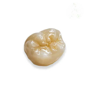 Monolithic Zirconia Conventional Crown (TLZ)
