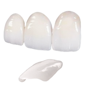 Veneers Additional Units