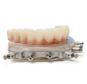 CHROME GuidedSMILE Basic